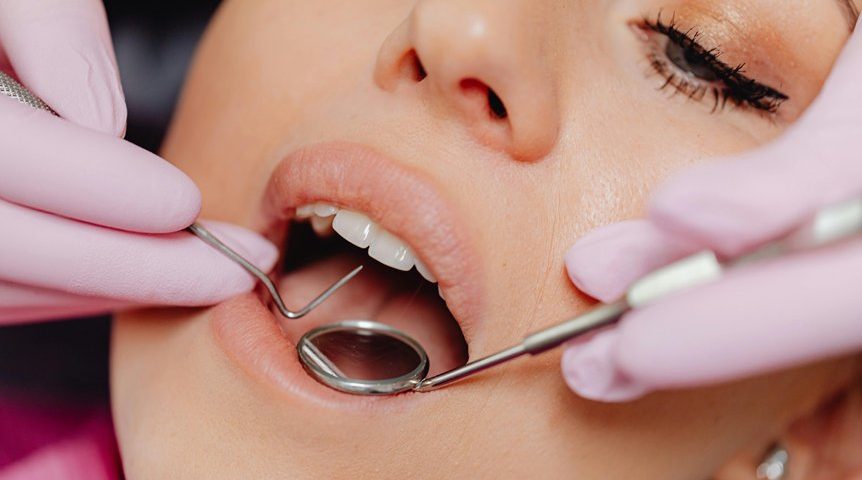 dental check up services